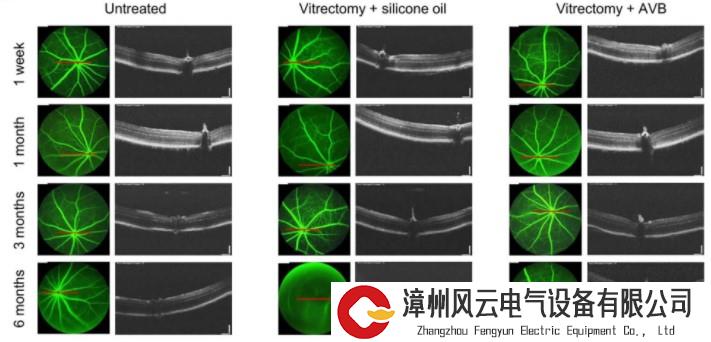 登Nature Materials！脉络膜黑色素瘤疗法获突破，苏州大学新型水凝胶“立大功”