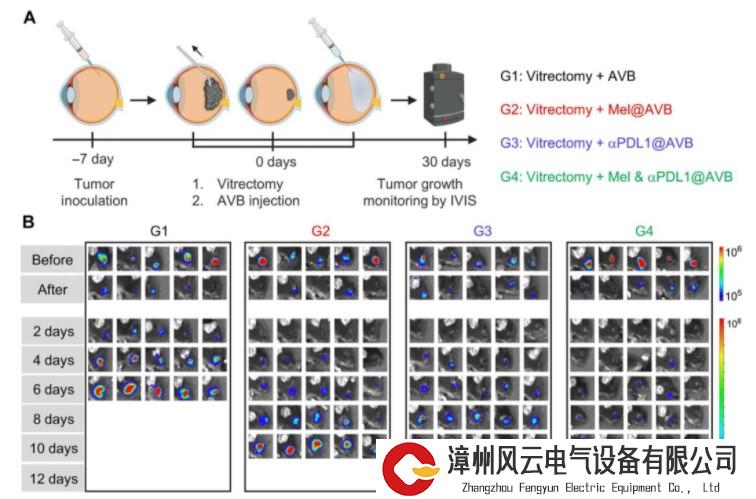 登Nature Materials！脉络膜黑色素瘤疗法获突破，苏州大学新型水凝胶“立大功”